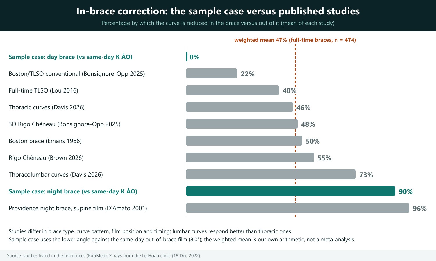 How to read: each horizontal bar is the mean in-brace correction of one study (the percentage by which the curve is reduced in the brace versus out of it); the dark green bars are the sample case, the grey bars are studies. The dashed orange line is the sample-size-weighted mean of the full-time-brace studies. The longer the bar, the more the brace corrects. Brace type, curve pattern and film position differ between studies; lumbar curves respond better than thoracic curves; the sample case is a single patient.