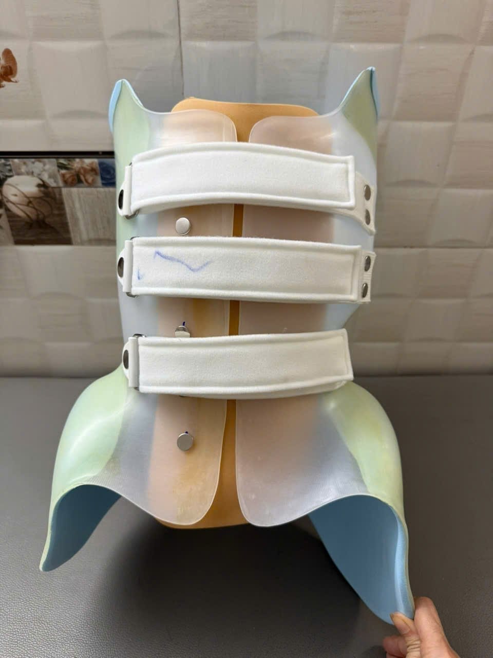 Áo nẹp nhựa nhiệt dẻo làm theo số đo từng trẻ: các dây đai Velcro cố định thân, lớp đệm bên trong tạo lực nắn chỉnh ở những vùng cần thiết. Áo nhẹ, có thể mặc trong quần áo.