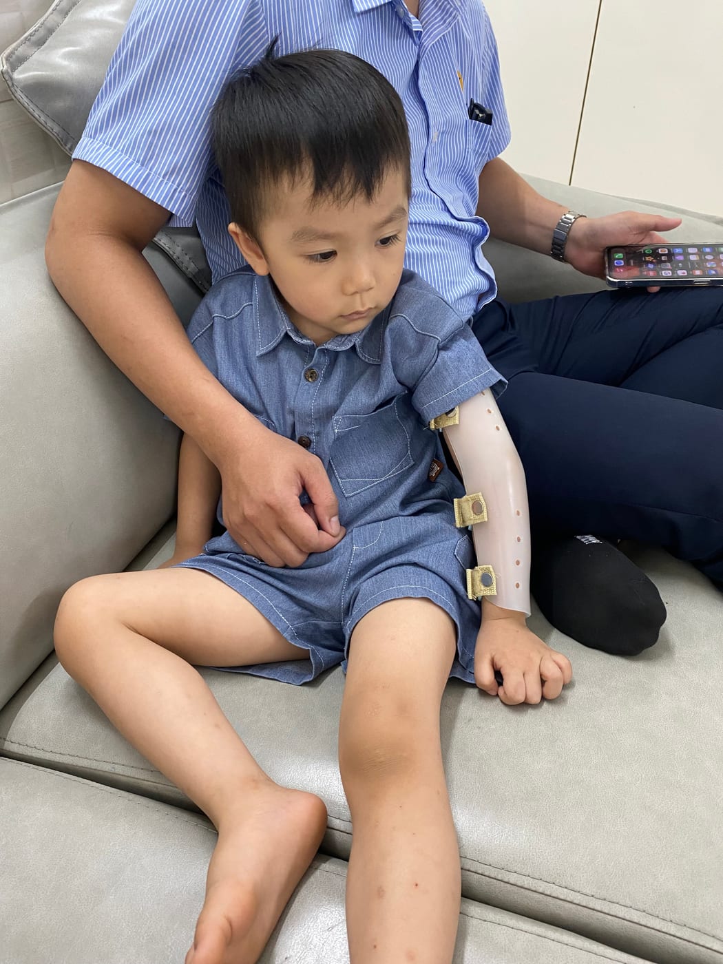 A young child using an arm orthosis (source: dungcuchinhhinh.vn)