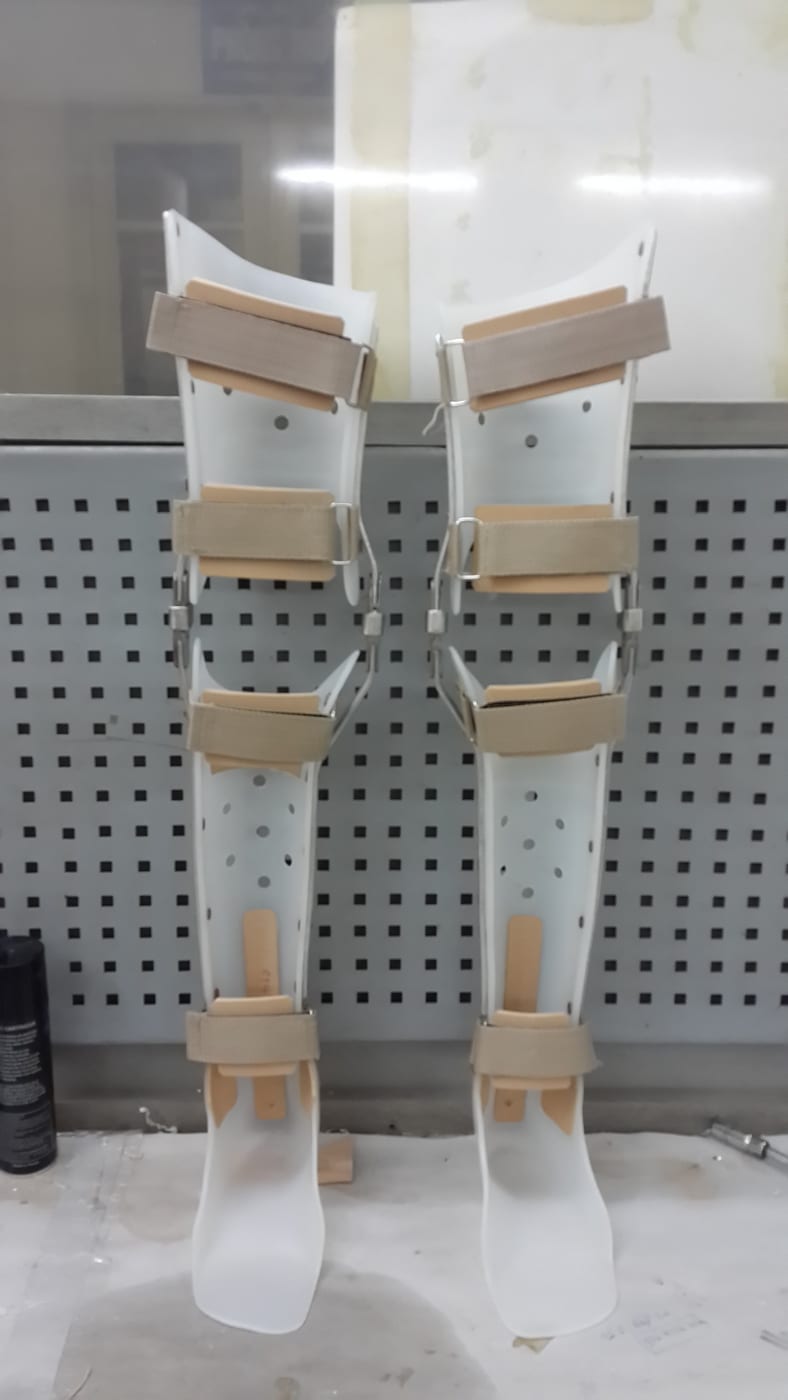Bilateral above-knee orthoses (KAFO) (source: dungcuchinhhinh.vn)