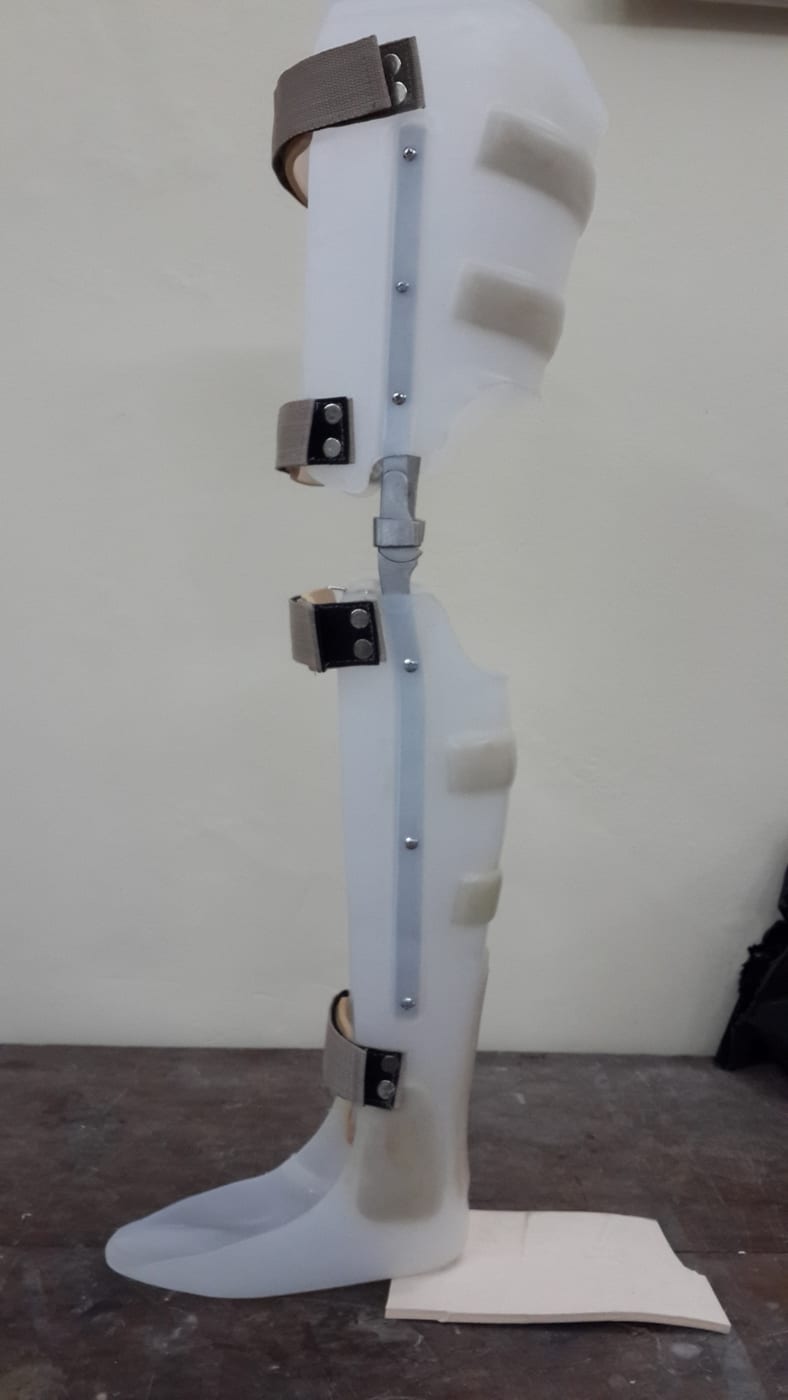 KAFO (knee-ankle-foot orthosis): an above-knee brace covering thigh, knee joint, shank and foot; close-up of the knee joint, which keeps the knee stable when thigh muscles are weak.