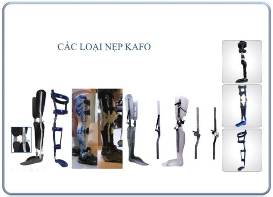 Ortosis lutut-pergelangan-kaki (KAFO) & pinggul-KAFO (HKAFO)
