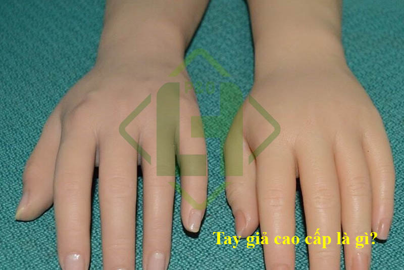 Prostesis anggota atas fungsional & kosmetik